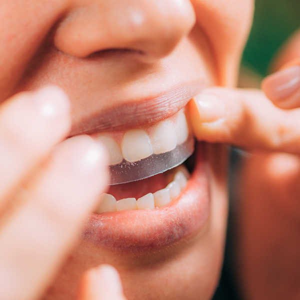 Woman Using Whitening Stipes or Whitestrips