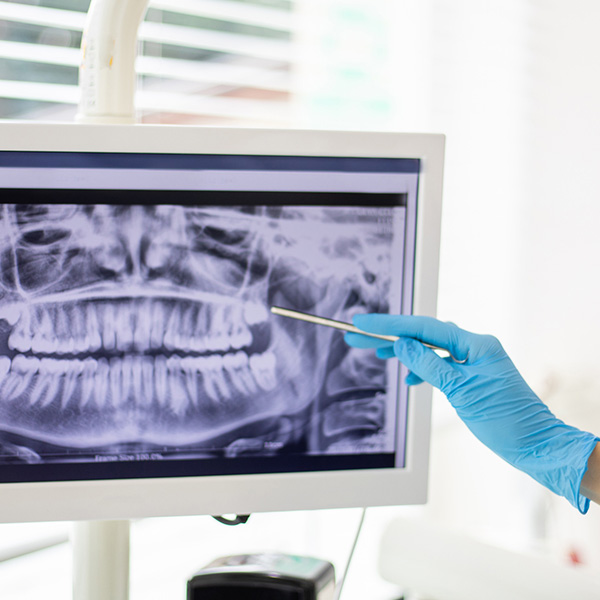 dental radiogram on screen